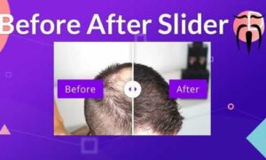 Divi-Sensei-Before-After-Slider-GPL